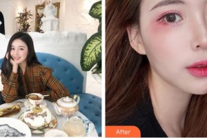 宣城眼科醫(yī)院查敦傳整形價(jià)格表附眼部綜合案例展示