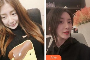 杭州華山連天美醫(yī)療美容整形醫(yī)院金鐘瑞整形價(jià)格表附鼻部整形案例展示