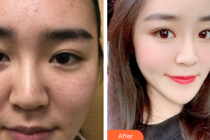 廣州圣諾達醫(yī)療美容門診部曹珂整形價格表附抗衰產(chǎn)品案例展示