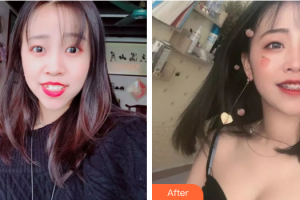 廣州穗華口腔醫(yī)院諶小麗整形價格表附牙齒矯正案例展示