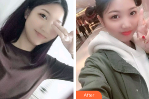 廣州暨博口腔醫(yī)院李艷平整形價(jià)格表附牙齒根管調(diào)節(jié)案例展示