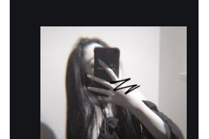 衡陽(yáng)雅美醫(yī)療美容醫(yī)院袁妍妍整形價(jià)格表附玻尿酸精華導(dǎo)入案例展示