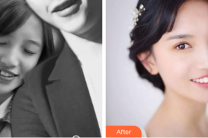 廣州愛康健口腔門診部郭俊偉整形價格表附金屬托槽矯正案例展示