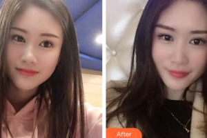 廣州愛(ài)康健口腔門(mén)診部韋秋紅整形價(jià)格表附冷光美白案例展示