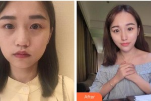 杭州東方整形外科門診部姜頌期整形價(jià)格表附抗衰老案例展示