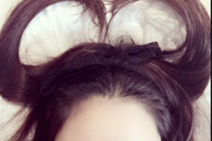 衡陽愛爾眼科醫(yī)院羅君整形價(jià)格表附眼部綜合案例展示