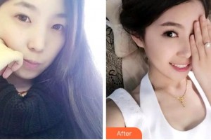 杭州香格里拉醫(yī)療美容醫(yī)院徐啟飛整形價(jià)格表附牙齒隱形矯正案例展示