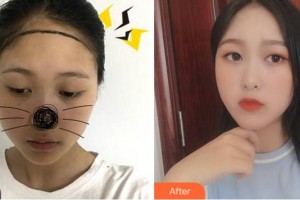 杭州新生毛發(fā)種植研究院王利軍整形價(jià)格表附種植發(fā)際線案例展示