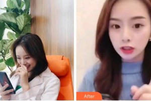 杭州時(shí)光醫(yī)療美容醫(yī)院黃志雄整形價(jià)格表附超聲波潔牙案例展示