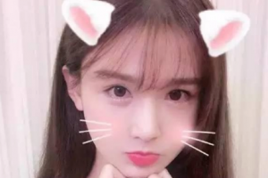 邵陽愛爾眼科醫(yī)院劉慧文整形價格表附切開雙眼皮案例展示