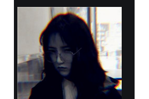 邵陽愛爾眼科醫(yī)院謝建國整形價格表附眼部綜合案例展示