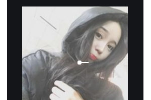 邵陽愛爾眼科醫(yī)院楊明軒整形價格表附外切祛眼袋案例展示