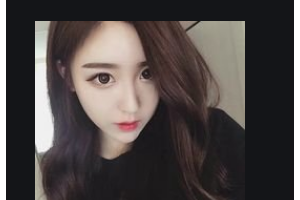 岳陽愛思特醫(yī)療美容醫(yī)院薛紅宇整形價(jià)格表附自體脂肪填充額頭案例展示