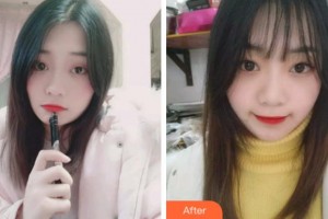 杭州華山連天美醫(yī)療美容整形醫(yī)院姜鑫利整形價格表附牙齒隱形矯正案例展示