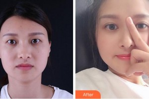 杭州整形醫(yī)院唐冬生整形價格表附眼部綜合案例展示