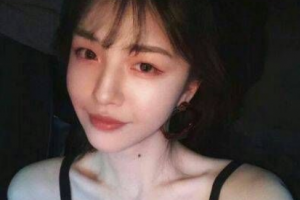 岳陽愛美麗醫(yī)療美容門診部洪政秀整形價(jià)格表附微針美膚案例展示