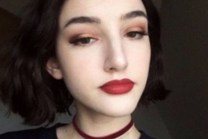 岳陽美蒂珂醫(yī)療美容門診部甘耀鵬整形價格表附光子嫩膚案例展示