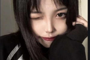 常德燒傷整形醫(yī)院陳志勇整形價格表附自體脂肪全臉填充案例展示