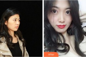 杭州格萊美整形美容醫(yī)院牛勇敢整形價(jià)格表附鼻部綜合案例展示