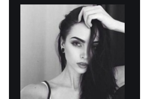 常德燒傷整形醫(yī)院魯世聞?wù)蝺r格表附自體脂肪全臉填充案例展示