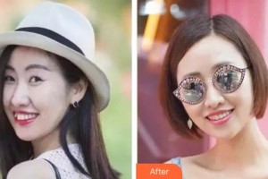 杭州美奧口腔門(mén)診部王明整形價(jià)格表附隱形托槽矯正案例展示