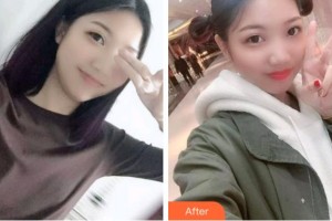 義烏杭州口腔門(mén)診部王仁飛整形價(jià)格表附根管調(diào)節(jié)案例展示