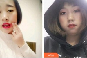 杭州協(xié)友口腔門(mén)診部沈月忠整形價(jià)格表附根管調(diào)節(jié)案例展示