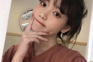 常德口腔醫(yī)院樊明文整形價(jià)格表附金屬托槽矯正案例展示