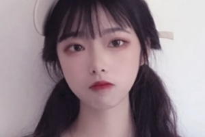 益陽德美整形醫(yī)院周超整形價(jià)格表附金屬托槽矯正案例展示