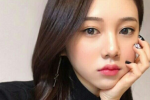 益陽市中心醫(yī)院美容整形科劉安久整形價(jià)格表附玻尿酸墊下巴案例展示