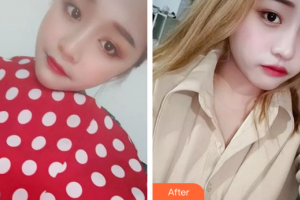 中信惠州醫(yī)院醫(yī)學(xué)整形中心周球律整形價格表附水光補水案例展示