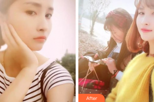 惠州白天鵝口腔醫(yī)院王文壇整形價(jià)格表附皓齒美白案例展示