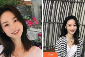 杭州品凱口腔醫(yī)院高春林整形價格表附牙綜合案例展示