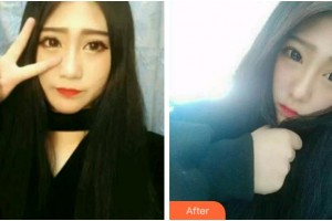 杭州品凱口腔醫(yī)院許晶整形價格表附牙齒隱形矯正案例展示