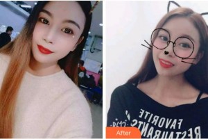 杭州亮貝美口腔醫(yī)院李詩佩整形價格表附牙貼面案例展示