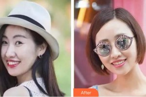 杭州良渚口腔門診部毛俏蕾整形價格表附隱形托槽矯正案例展示