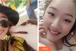 杭州博凡口腔門診部張弘整形價(jià)格表附牙齒隱形矯正案例展示