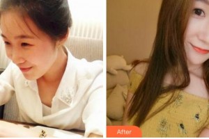 寧波尚麗整形美容醫(yī)院朱紅霞整形價格表附熱瑪吉案例展示