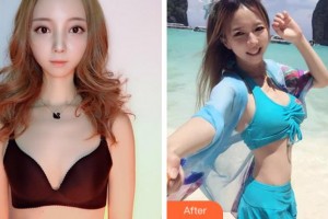 寧波珈禾整形?？漆t(yī)院雷中元整形價格表附自體脂肪隆胸案例展示