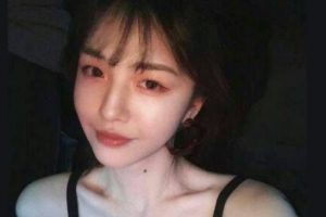 懷化愛爾眼科醫(yī)院袁小江整形價格表附光子嫩膚案例展示