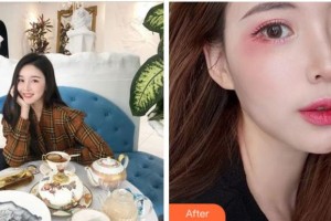 寧波韓美醫(yī)療美容門診部厲春玲整形價(jià)格表附眼部綜合案例展示