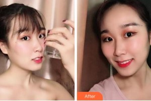 寧波拜博拜爾口腔醫(yī)院高輝整形價(jià)格表附牙齒隱形矯正案例展示