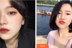 寧波鄞州眼科醫(yī)院朱佰傳整形價格表附眼部綜合案例展示