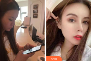 深圳幸福醫(yī)療美容門診部李丹陽(yáng)整形價(jià)格表附假體豐眉弓案例展示