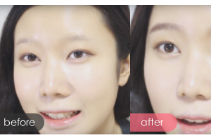 深圳鵬程醫(yī)院整形美容中心劉卓雅整形價格表附紋眉案例展示