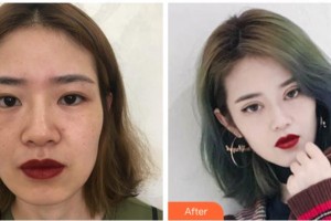 溫州雅美姬整形美容醫(yī)院尹卿準(zhǔn)整形價(jià)格表附眼部綜合案例展示