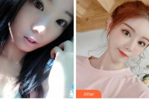 溫州友好醫(yī)院整形美容中心陳祥整形價(jià)格表附眼部綜合案例展示