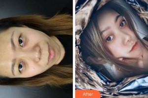 溫州和平整形醫(yī)院邵晉整形價(jià)格表附雙眼皮案例展示