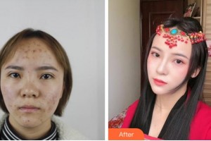 溫州友好醫(yī)院整形美容中心尹建祥整形價格表附鼻部綜合案例展示