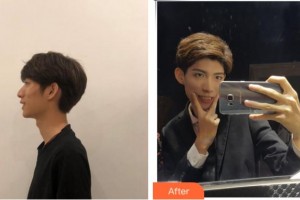 溫州拜博口腔醫(yī)院賈道真整形價(jià)格表附牙齒隱形矯正案例展示